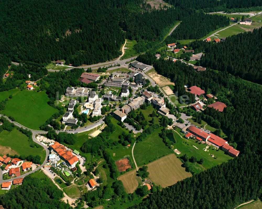 Sankt Englmar aus der Vogelperspektive: Gebäudekomplex der Hotelanlage Predigtstuhl Resort GmbH in Sankt Englmar im Bundesland Bayern, Deutschland