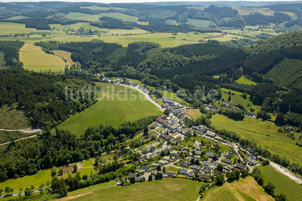 Luftbild Schmallenberg - Gebäudekomplex der Hotelanlage des Romantik- und Welnesshotel Deimann in Schmallenberg im Bundesland Nordrhein-Westfalen