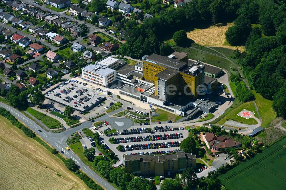 Luftaufnahme Höxter - Klinikgelände des Klinikum Weser-Egge - St. Ansgar Krankenhaus Höxter in Höxter im Bundesland Nordrhein-Westfalen - NRW, Deutschland