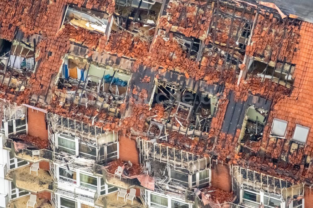 Bochum aus der Vogelperspektive: Klinikgelände des Krankenhauses BG Universitätsklinikum Bergmannsheil in Bochum im Bundesland Nordrhein-Westfalen, Deutschland