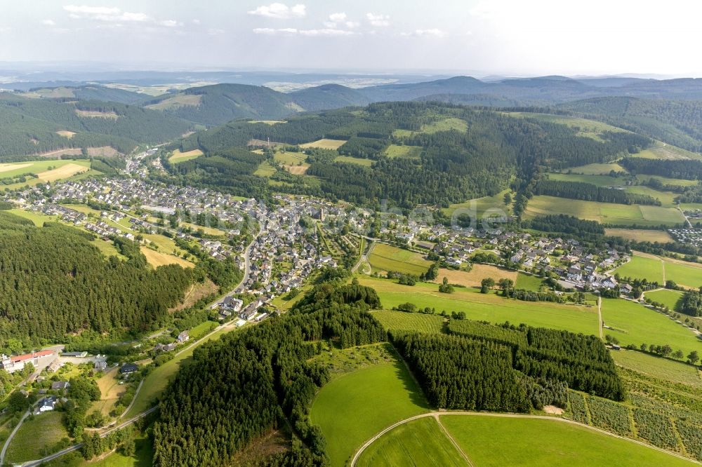 Winterberg aus der Vogelperspektive: Stadtansicht von Winterberg und Umgebung in Winterberg in Nordrhein-Westfalen